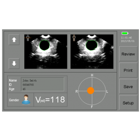 bladderscan CARESONO HD 3